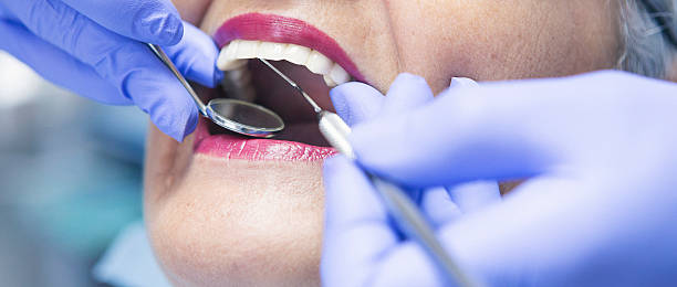 Best Emergency Dental Care for Abscessed Tooth in Trenton, TN